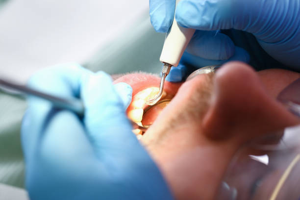 Best Emergency Treatment for Oral Infections in Twin Lakes, VA
